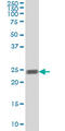 RAB5A, Member RAS Oncogene Family antibody, LS-C198047, Lifespan Biosciences, Western Blot image 