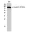 Insulin Receptor antibody, STJ90815, St John