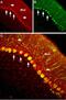 Sodium Voltage-Gated Channel Beta Subunit 2 antibody, GTX54799, GeneTex, Immunohistochemistry frozen image 