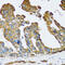Citrin antibody, 14-506, ProSci, Immunohistochemistry paraffin image 