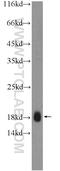 Thioredoxin reductase 3 intronic transcript 1 antibody, 25753-1-AP, Proteintech Group, Western Blot image 