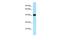 Poly(ADP-ribose) glycohydrolase ARH3 antibody, PA5-45851, Invitrogen Antibodies, Western Blot image 