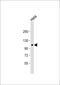 Adhesion G Protein-Coupled Receptor F4 antibody, 59-870, ProSci, Western Blot image 