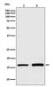 Glutathione Peroxidase 4 antibody, M02059, Boster Biological Technology, Western Blot image 