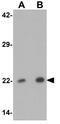 Paired Like Homeobox 2B antibody, GTX31486, GeneTex, Western Blot image 
