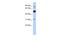 BEN Domain Containing 2 antibody, A18250, Boster Biological Technology, Western Blot image 