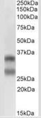 TNF Superfamily Member 11 antibody, NB100-56512, Novus Biologicals, Western Blot image 