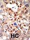 Promyelocytic Leukemia antibody, 61-401, ProSci, Immunohistochemistry paraffin image 