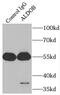 Aldolase, Fructose-Bisphosphate B antibody, FNab00302, FineTest, Immunoprecipitation image 