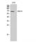 Interleukin 1 Receptor Associated Kinase 3 antibody, LS-C384177, Lifespan Biosciences, Western Blot image 