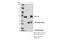 Lymphocyte Cytosolic Protein 2 antibody, 70896S, Cell Signaling Technology, Immunoprecipitation image 