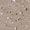 Zinc Finger And BTB Domain Containing 46 antibody, PA5-53107, Invitrogen Antibodies, Immunohistochemistry paraffin image 