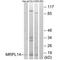 Mitochondrial Ribosomal Protein L14 antibody, A13011, Boster Biological Technology, Western Blot image 