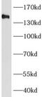 AF4/FMR2 Family Member 4 antibody, FNab00197, FineTest, Western Blot image 