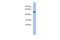 Cbl Proto-Oncogene Like 1 antibody, PA5-41638, Invitrogen Antibodies, Western Blot image 