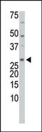 Thioredoxin Like 1 antibody, 57-017, ProSci, Western Blot image 