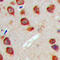 WASP Family Member 3 antibody, LS-C358390, Lifespan Biosciences, Immunohistochemistry paraffin image 