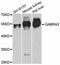 Gamma-Aminobutyric Acid Type A Receptor Alpha3 Subunit antibody, LS-C747047, Lifespan Biosciences, Western Blot image 