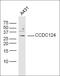 Coiled-Coil Domain Containing 134 antibody, orb2322, Biorbyt, Western Blot image 