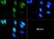 Leucine Rich Repeat Kinase 2 antibody, NBP1-78299, Novus Biologicals, Immunofluorescence image 