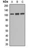 GEN1 Holliday Junction 5' Flap Endonuclease antibody, LS-C668974, Lifespan Biosciences, Western Blot image 