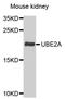 Ubiquitin Conjugating Enzyme E2 A antibody, orb373734, Biorbyt, Western Blot image 
