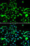 Inositol Hexakisphosphate Kinase 2 antibody, STJ29272, St John