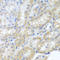 Peroxisomal Biogenesis Factor 3 antibody, A04166-1, Boster Biological Technology, Immunohistochemistry paraffin image 