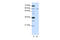 Frizzled Class Receptor 5 antibody, 29-539, ProSci, Enzyme Linked Immunosorbent Assay image 
