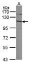 Exosome Component 10 antibody, GTX107856, GeneTex, Western Blot image 