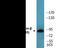 Catenin Beta 1 antibody, EKC2361, Boster Biological Technology, Western Blot image 