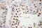 Nuclear Autoantigenic Sperm Protein antibody, 11323-1-AP, Proteintech Group, Immunohistochemistry paraffin image 