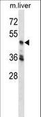 Cyclin Dependent Kinase 18 antibody, LS-C163454, Lifespan Biosciences, Western Blot image 