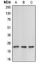 Cerebellin 2 Precursor antibody, orb215382, Biorbyt, Western Blot image 