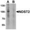 N-Deacetylase And N-Sulfotransferase 2 antibody, PA5-72813, Invitrogen Antibodies, Western Blot image 