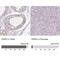 PARP2 antibody, NBP2-47337, Novus Biologicals, Immunohistochemistry paraffin image 