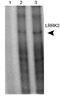 Leucine Rich Repeat Kinase 2 antibody, PA1-16770, Invitrogen Antibodies, Immunoprecipitation image 