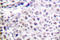 Aurora Kinase B antibody, LS-C176581, Lifespan Biosciences, Immunohistochemistry paraffin image 