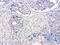 Serpin Family B Member 4 antibody, LS-C799206, Lifespan Biosciences, Immunohistochemistry paraffin image 