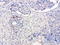 Serpin B4 antibody, LS-C799206, Lifespan Biosciences, Immunohistochemistry paraffin image 