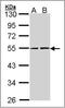 RuvB Like AAA ATPase 2 antibody, AP23165PU-N, Origene, Western Blot image 