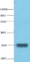 Lipocalin 2 antibody, MBS719414, MyBioSource, Western Blot image 