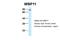 WW Domain Binding Protein 11 antibody, NBP1-54648, Novus Biologicals, Immunohistochemistry paraffin image 