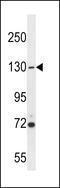 Ubiquitin Specific Peptidase 7 antibody, 58-667, ProSci, Western Blot image 