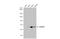 Polypeptide N-Acetylgalactosaminyltransferase 2 antibody, GTX104070, GeneTex, Western Blot image 