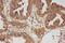 Calpain 1 antibody, PA1364, Boster Biological Technology, Immunohistochemistry paraffin image 