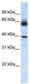 Karyopherin Subunit Alpha 1 antibody, TA335050, Origene, Western Blot image 