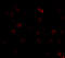 Component Of Inhibitor Of Nuclear Factor Kappa B Kinase Complex antibody, 2115, QED Bioscience, Immunofluorescence image 