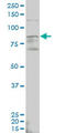 Aldehyde Dehydrogenase 18 Family Member A1 antibody, LS-C198041, Lifespan Biosciences, Western Blot image 