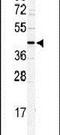 Sister chromatid cohesion protein DCC1 antibody, PA5-12504, Invitrogen Antibodies, Western Blot image 